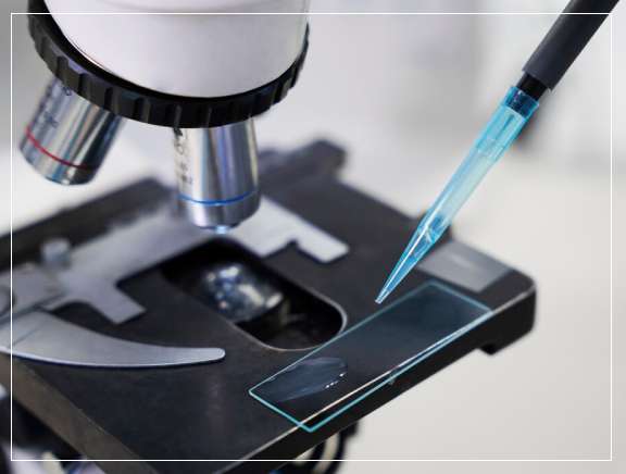 Why is a Biopsy Performed?