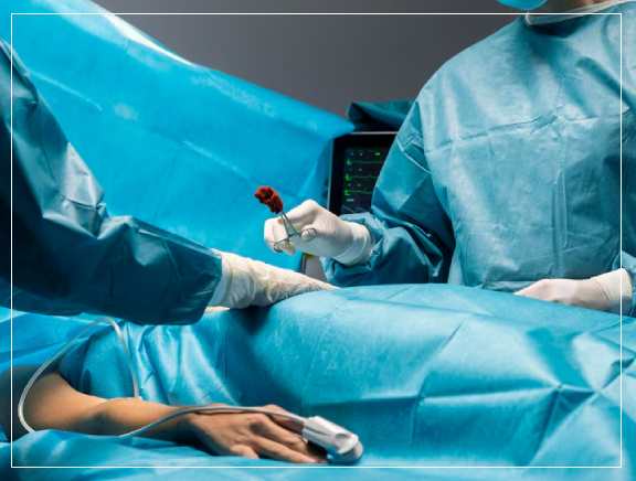 Types of Circumcision Surgery