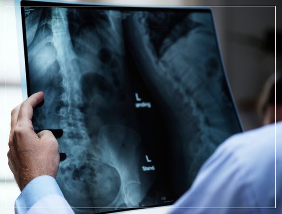 Pediatric Digital X-ray Pediatric Digital X-ray