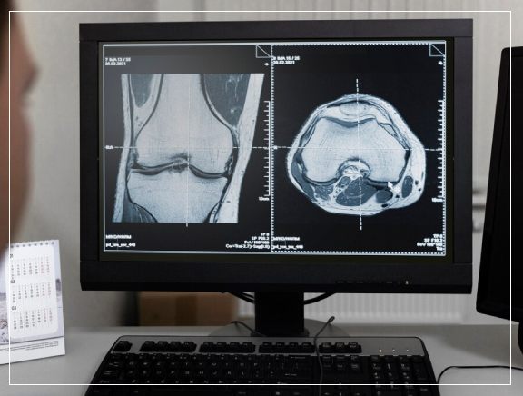 Benefits of Opting Digital X-ray at Vitadell <br />
Benefits of Opting Digital X-ray at Vitadell