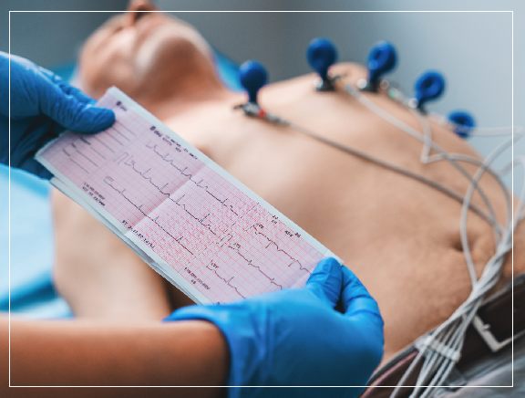 How ECG Works