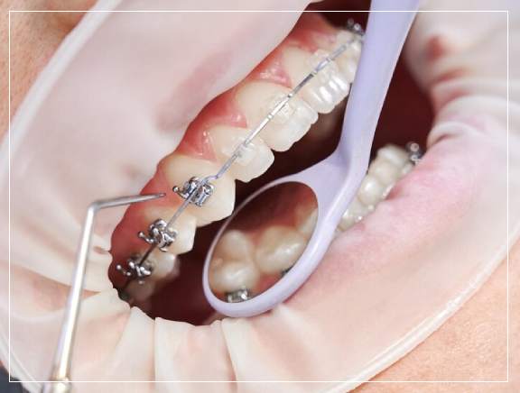 When to Consider Maxillofacial Surgery When to Consider Maxillofacial Surgery