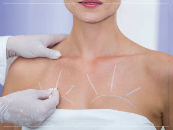 Upper Body Cosmetic Overview