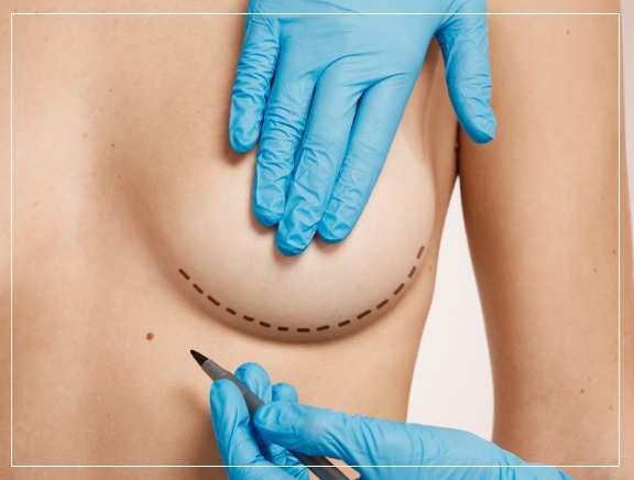 Why Vitadell is Best for Upper Body Cosmetic?