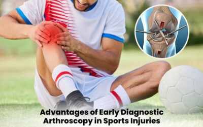 Advantages of Early Diagnostic Arthroscopy in Sports Injuries